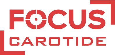 Focus carotide